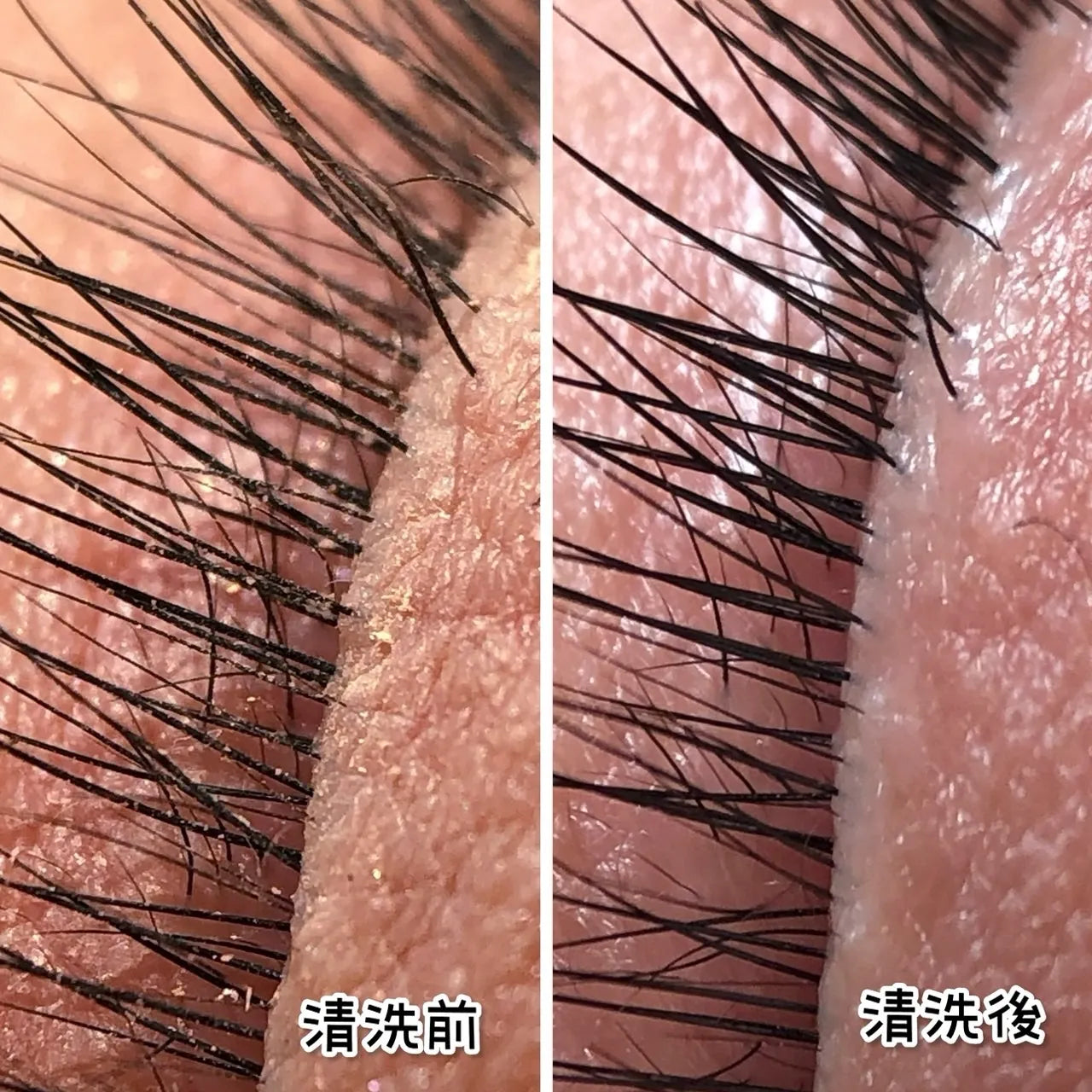 LIGHT EYES 亮妍 - LASH FOAM SPA 睫毛清潔慕斯  (100ml)